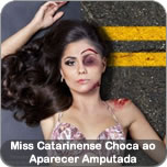 Miss Catarinense Choca ao Aparecer Amputada