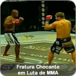 Fratura Chocante em Luta de MMA